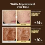 Dr. Reju-All Advanced Retino-Mela Serum – HPR Retinol Serum for Face – Anti-Aging, Pore Minimizer, Next-Gen Korean Skin care – Gentle & Beginner-Friendly – Niacinamide 10% & TXA 4% – 1 Fl Oz - Image 5